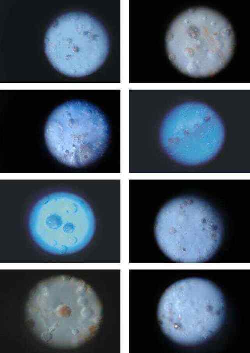宋代影青瓷器气泡大全