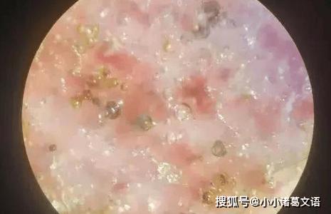 定窑瓷器气泡特征图片