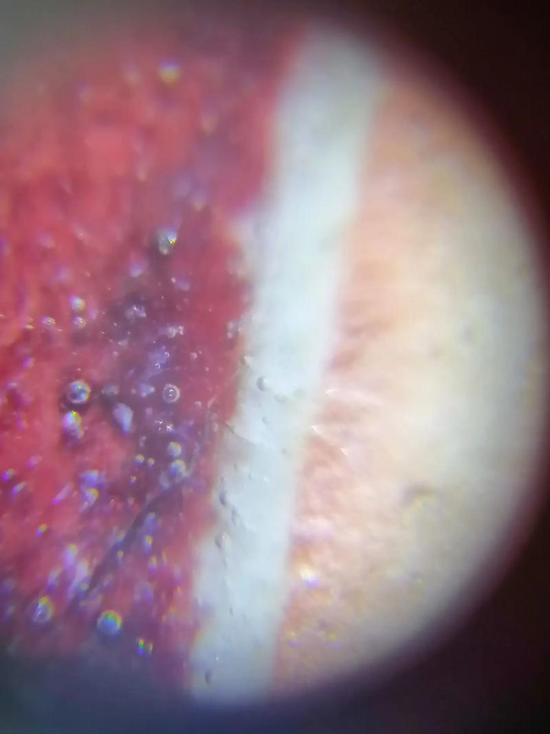 从瓷器气泡看瓷器新老